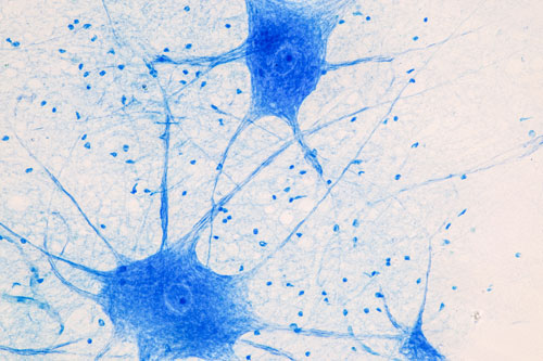 Bringing the Fight to Motor Neuron Disease: Selectively Treating Diseased Cells 