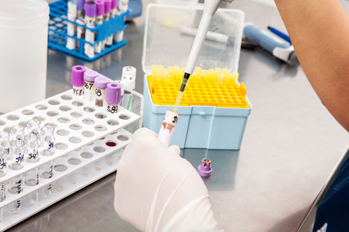 Sample Preparation in Flow Cytometry — Tips & Tricks