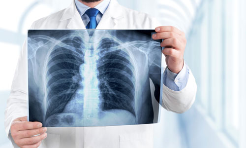 Franken-Swine: World’s First Pig-to-Human Lung Transplantation