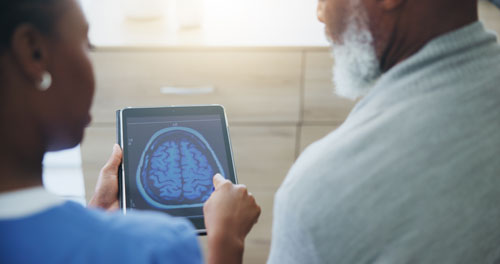 Could Exercising Reduce Your Risk of Alzheimer’s Disease?