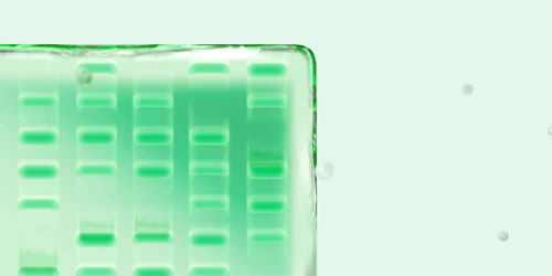 Stain-Free vs. No-Stain — Western Blotting Mythbusting