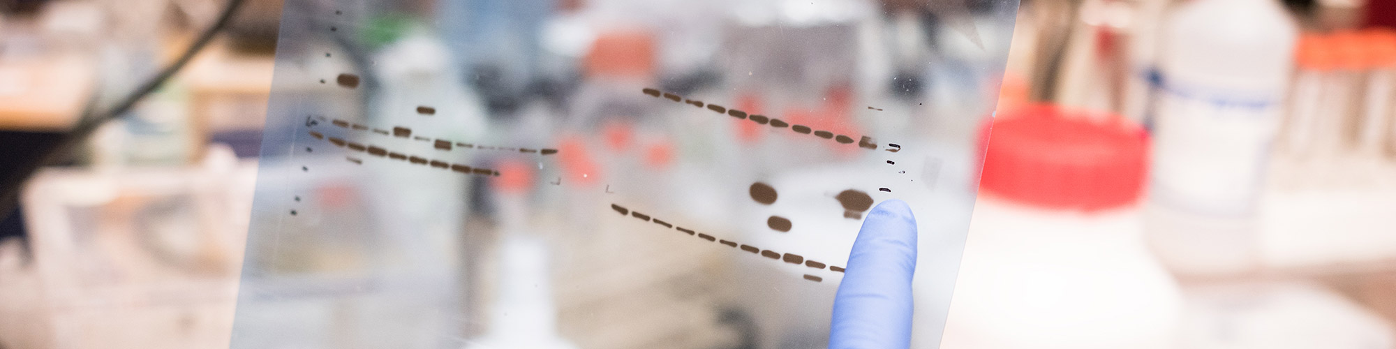 Taking Control of Your Western Blotting Troubles
