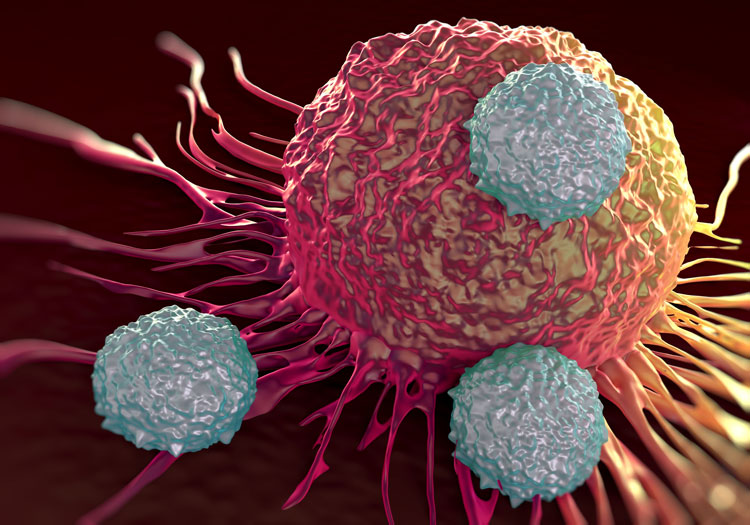 Iron and Ferroptosis: A Hidden Barrier to CAR T-Cell Function